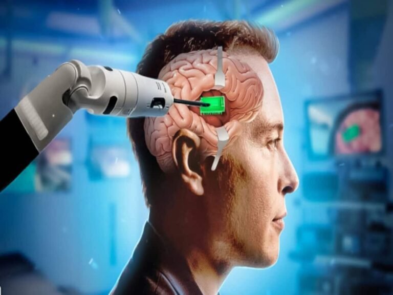 जब एलन मस्क ने इंसान के दिमाग में की चिप फिट!