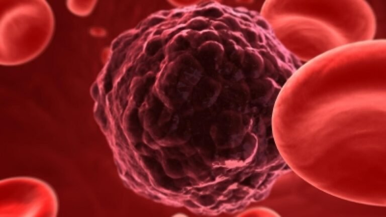 जब चिकित्सकों की टीम ने महिला को कैंसर से बचाया!