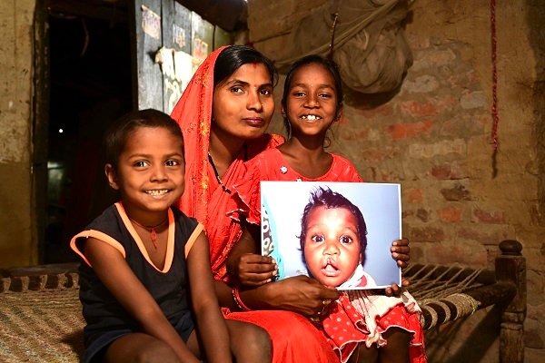 On World Cleft Awareness Day, Smile Train India Marks 800,000+ Free Surgeries and a Renewed Push for Early Diagnosis of Clefts